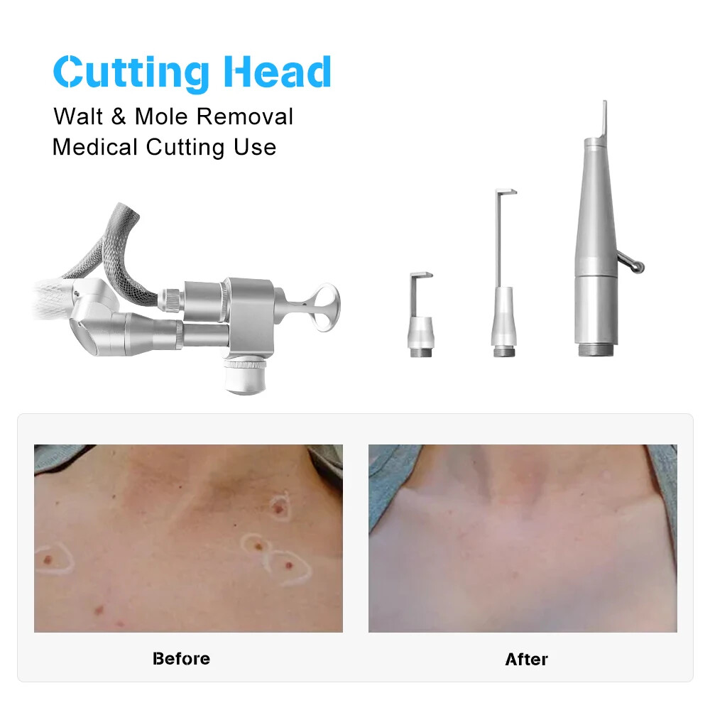 Fractional CO2 Laser Machine for Skin Resurfacing
