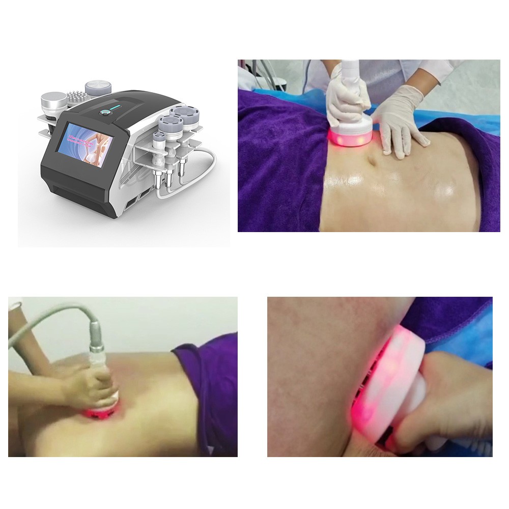 3D Body Sculpting Machine with Ultrasound and RF