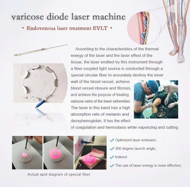 980nm 1470nm Diode Laser Machine for Vascular Treatment