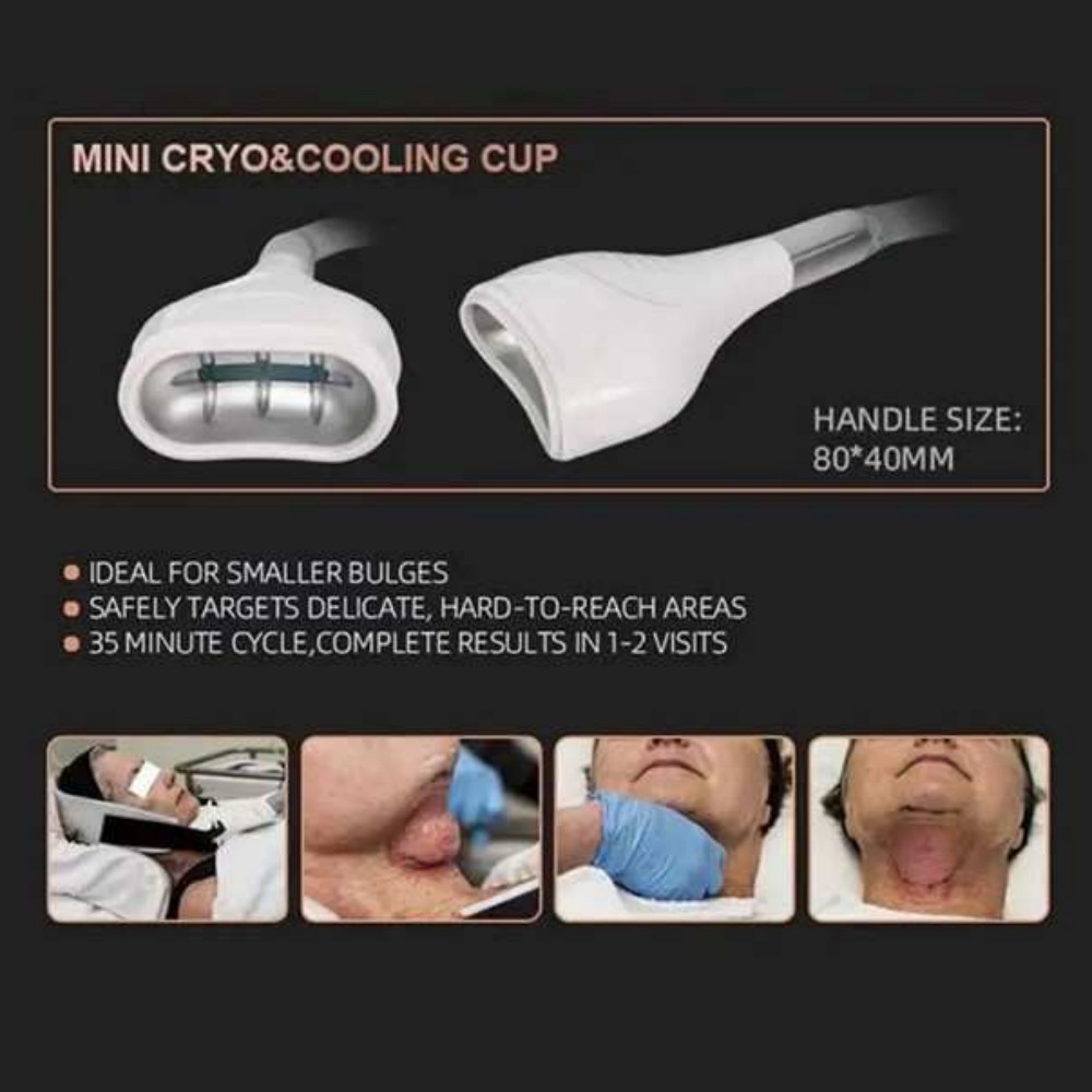 Cryolipolysis Fat Freezing Machine for Body Contouring