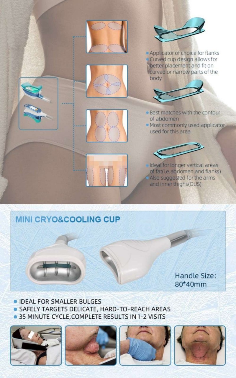 360° Cryolipolysis Machine 7 in 1 Cavitation RF Slimming