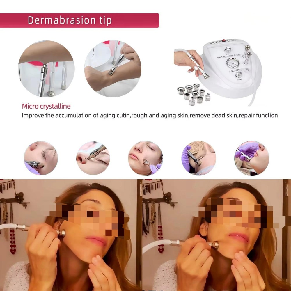 Diamond Microdermabrasion Machine for Blackhead Removal