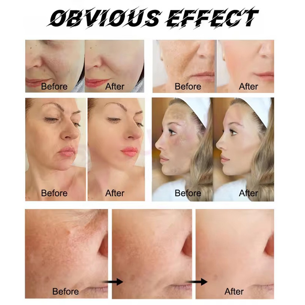 7 Color LED Light Therapy Machine for Skin Rejuvenation