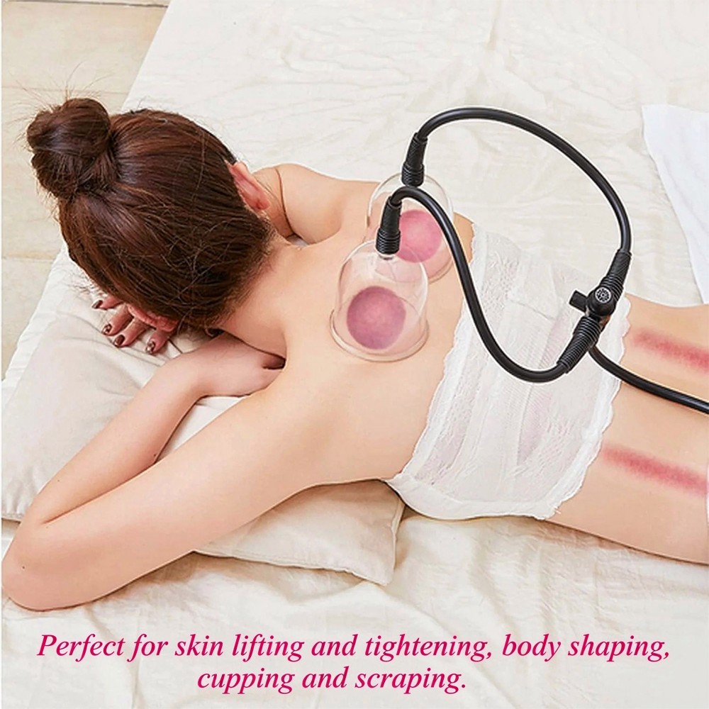 Vacuum Cupping Machine for Body Shaping and Massage